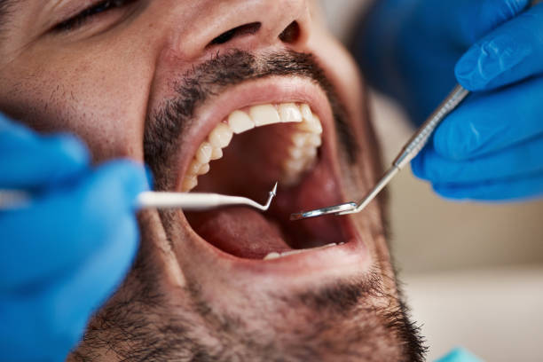 Best Emergency Dental Care for Sports Injuries in Ringgold, LA
